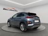 Hyundai Kona 1.6 CRDI 85kW (115CV) Tecno Red 4X2  - Foto 2